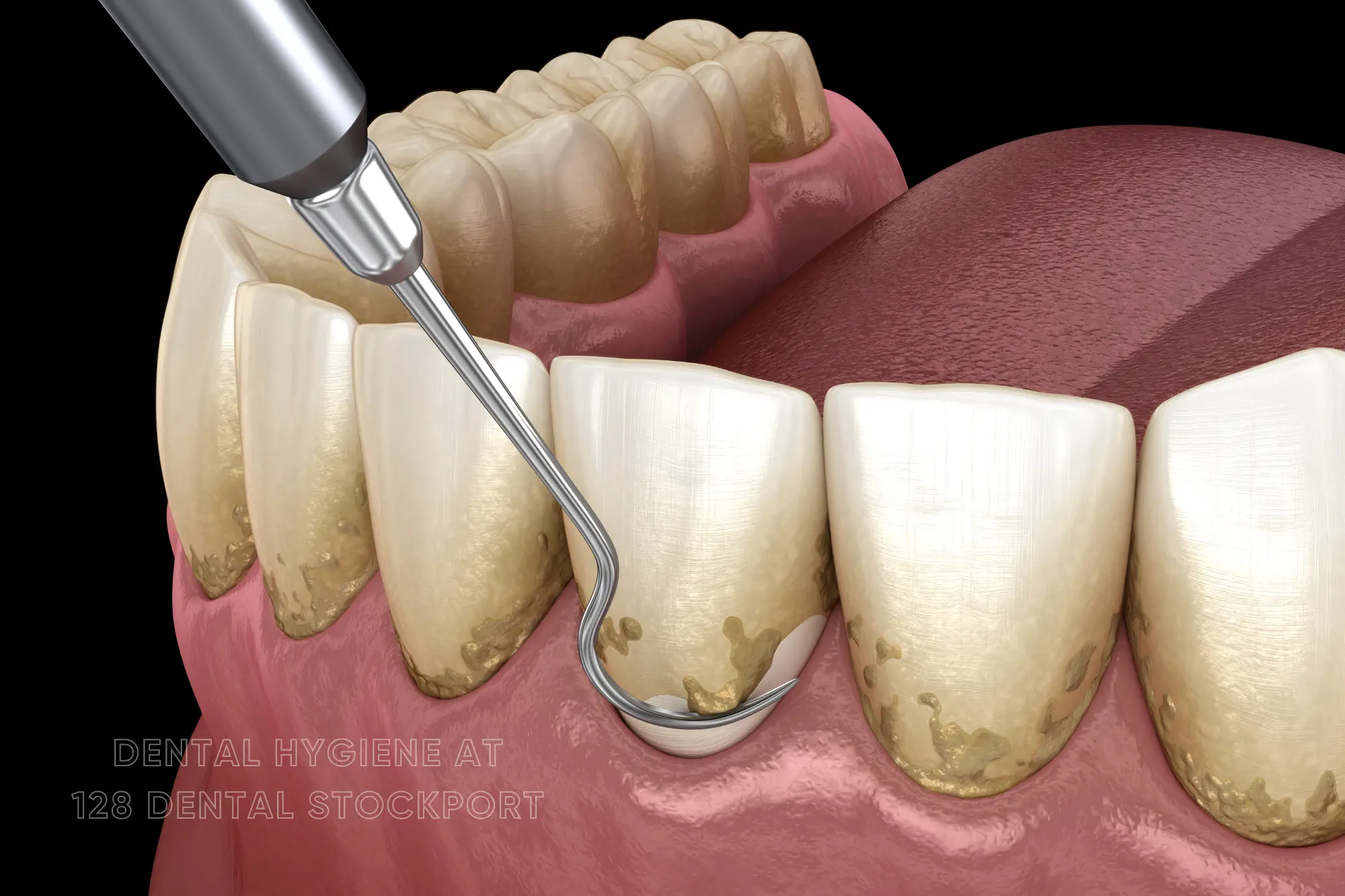 Dental hygiene at 128 dental practice in stockport